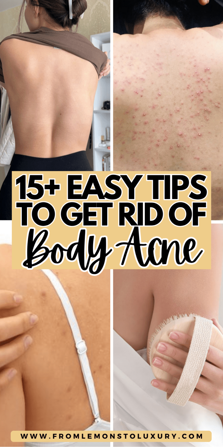 15+ Easy Tips On How To Get Rid Of Body Acne At Home