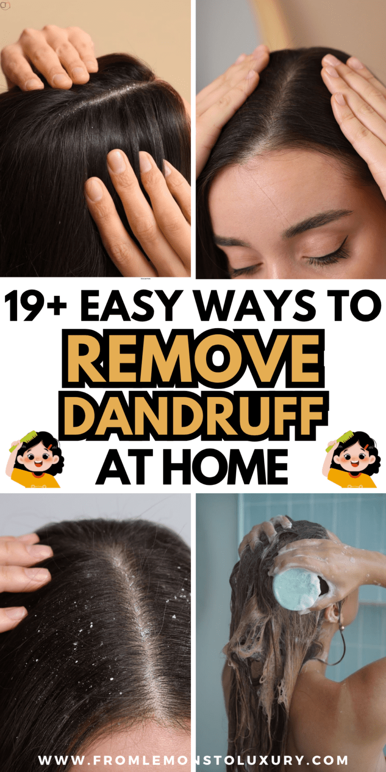 19+ Easy Ways To Remove Dandruff At Home For A Healthy Scalp